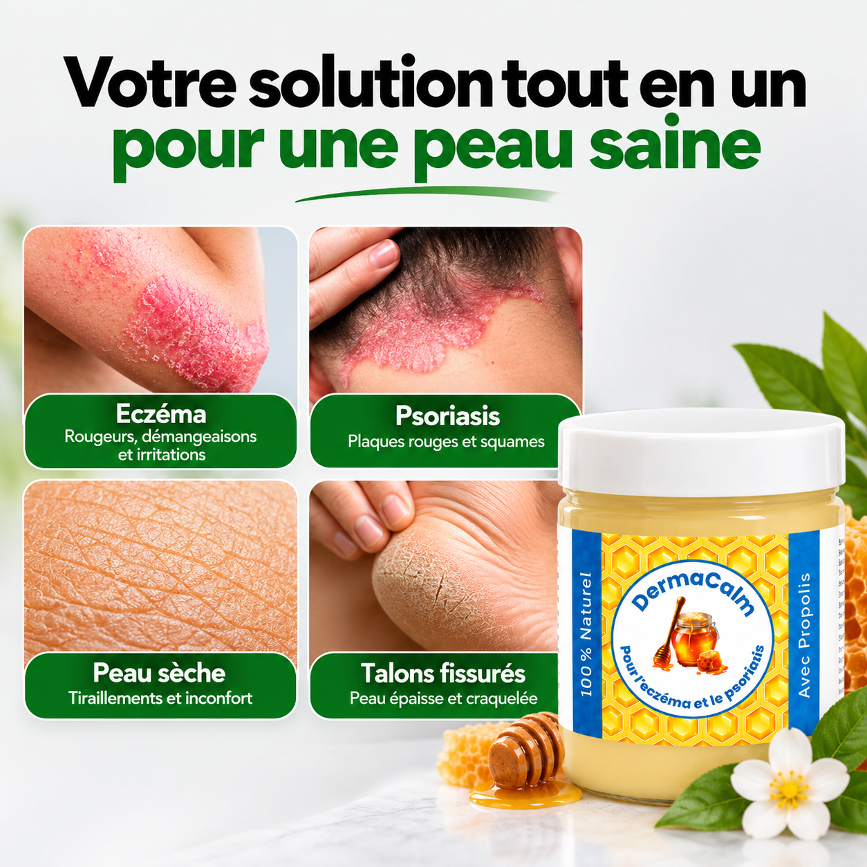 DermaCalm™ – Baume sans cortisone pour l'eczéma et le psoriasis